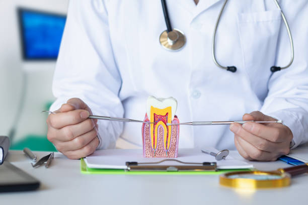 Best Emergency Root Canal Treatment in Lifornia Polytechnic State University, CA